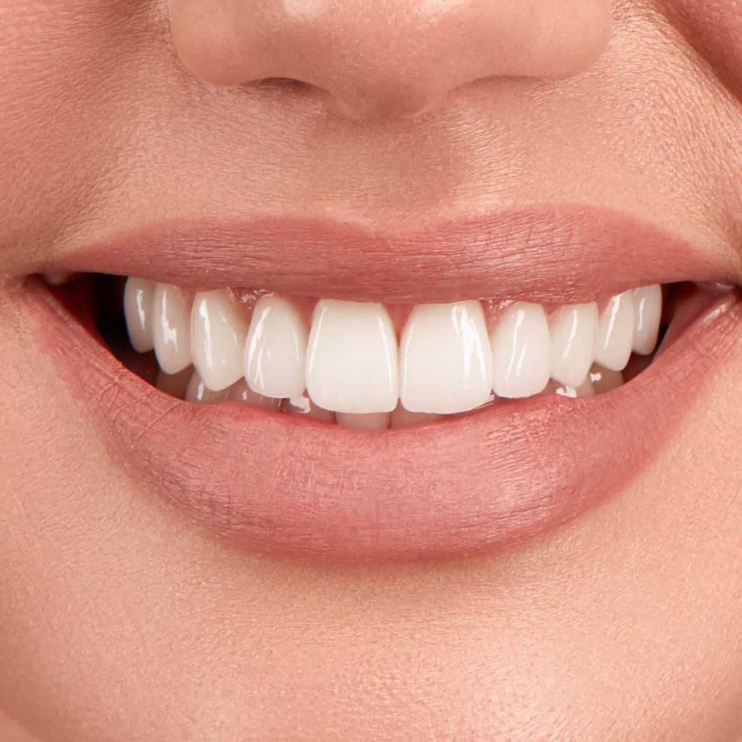 MINT by Dr Mintcheva Dental Spa schönes Lächeln