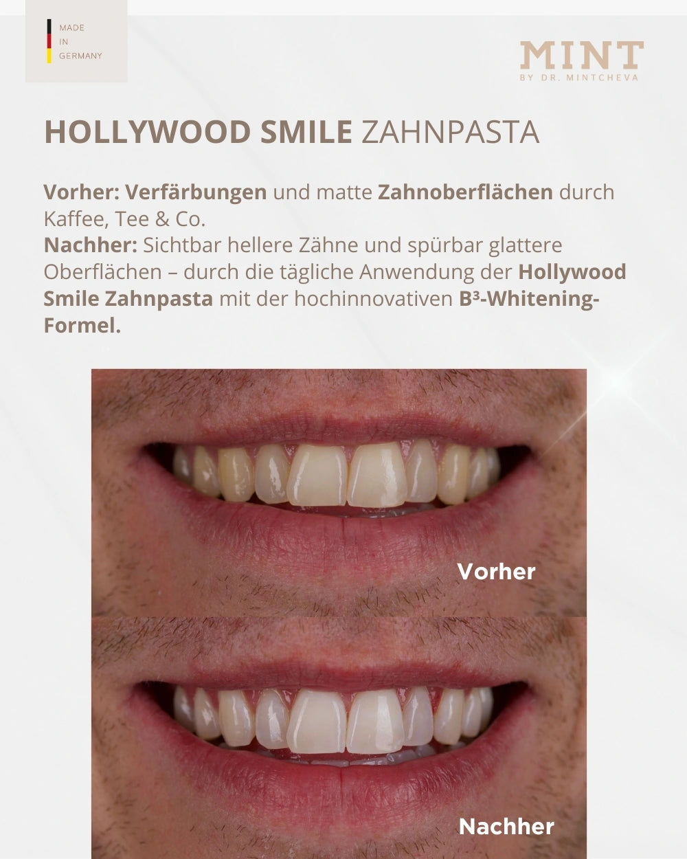 Set Hollywood Smile Zahnpasta & Polierpaste