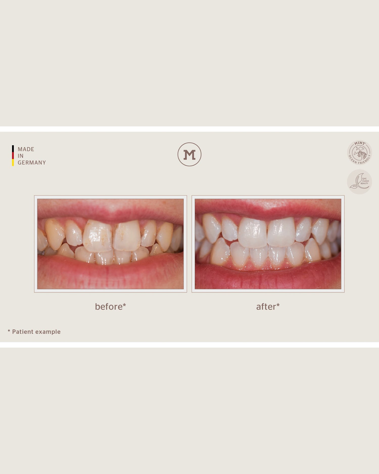 HOLLYWOOD WHITENING SPECIAL SET