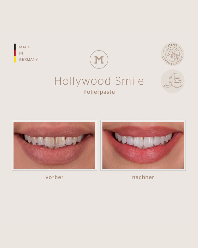 Hollywood Smile Polierpaste vorher nachher