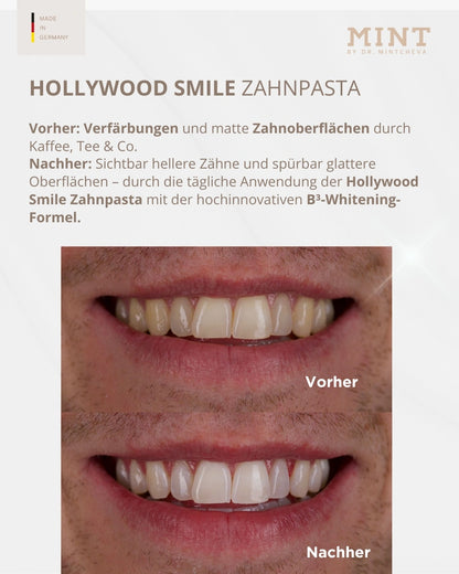 Set Hollywood Smile Zahnpasta &amp; Polierpaste