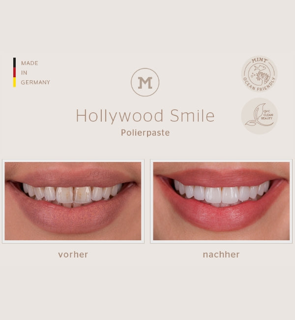 Banner Hollywood Smile Polierpaste: Beispiel Zähne