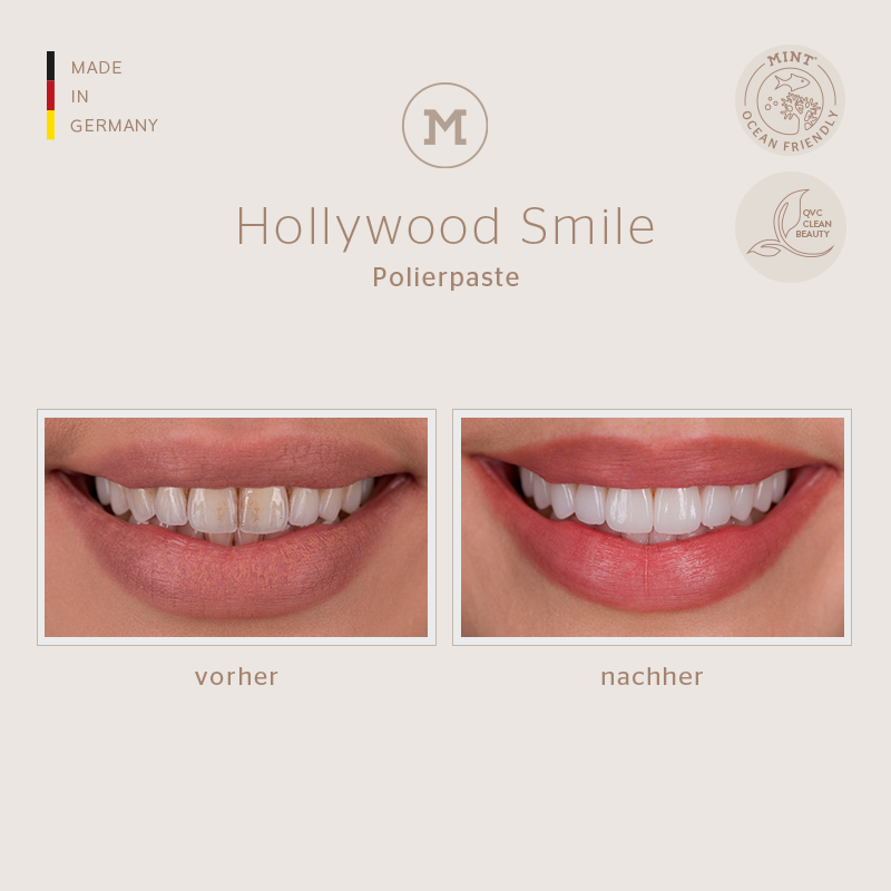 MINT Hollywood Smile Polishing Paste – Before and After Example